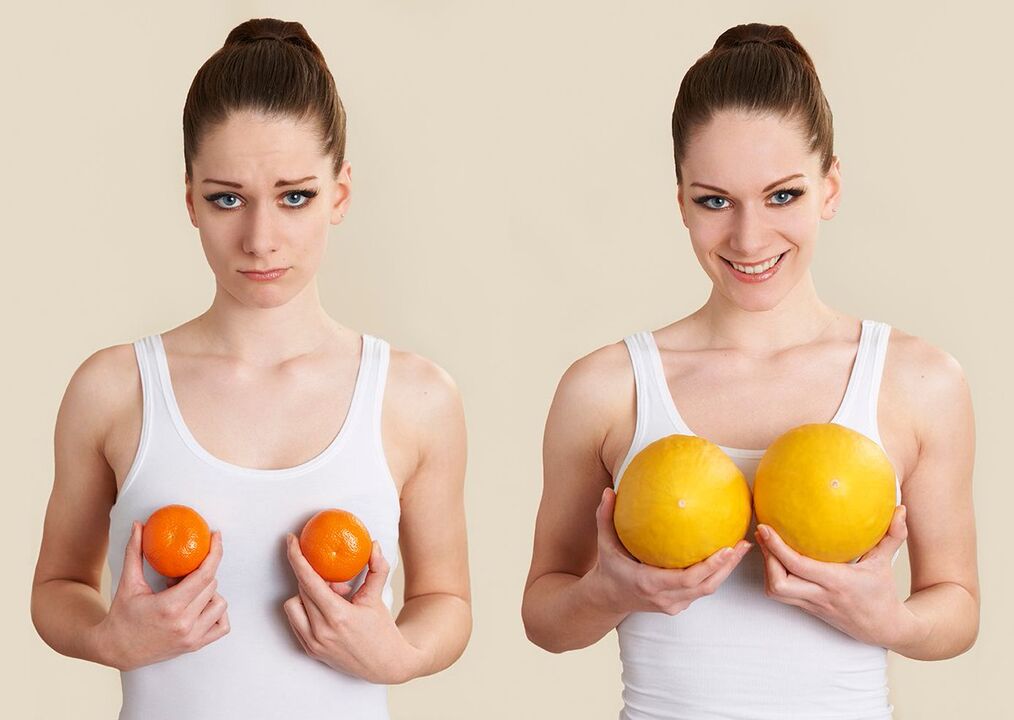 Correction of breast shape