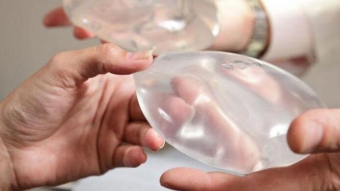The endoprostetics of breast