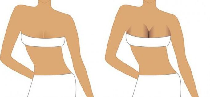 post -operation period